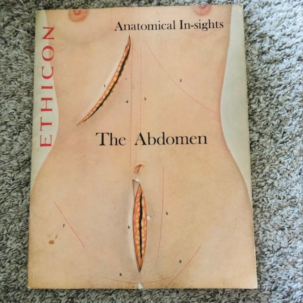 Vintage Medical Ephemera -Ethicon The Abdomen- Layers of Abdomen - Stitches 1968